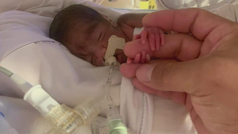 Un bébé prématuré né 18 semaines plus tôt s’en est bien sorti